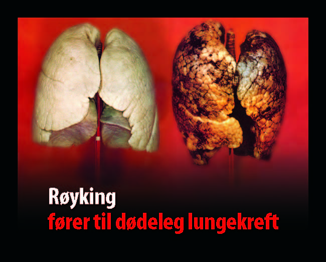 Norway Tobacco Labelling Regulations